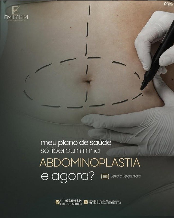 O Que Fazer Quando o Plano de Saúde Nega Suas Cirurgias Plásticas Reparadoras?